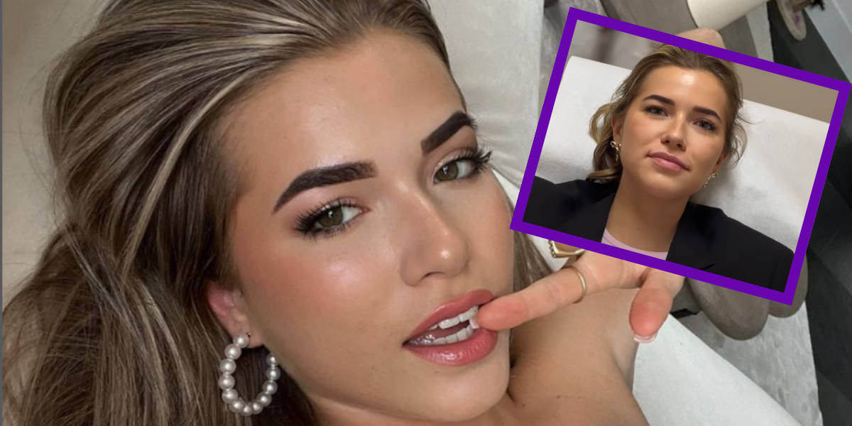 Jade Anna heeft fillers in haar lippen laten spuiten: ‘Onzeker’